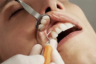 Cómo prevenir y tratar la enfermedad periodontal