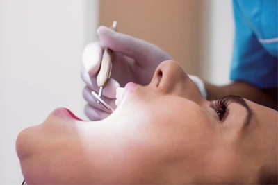 La importancia de las limpiezas dentales profesionales