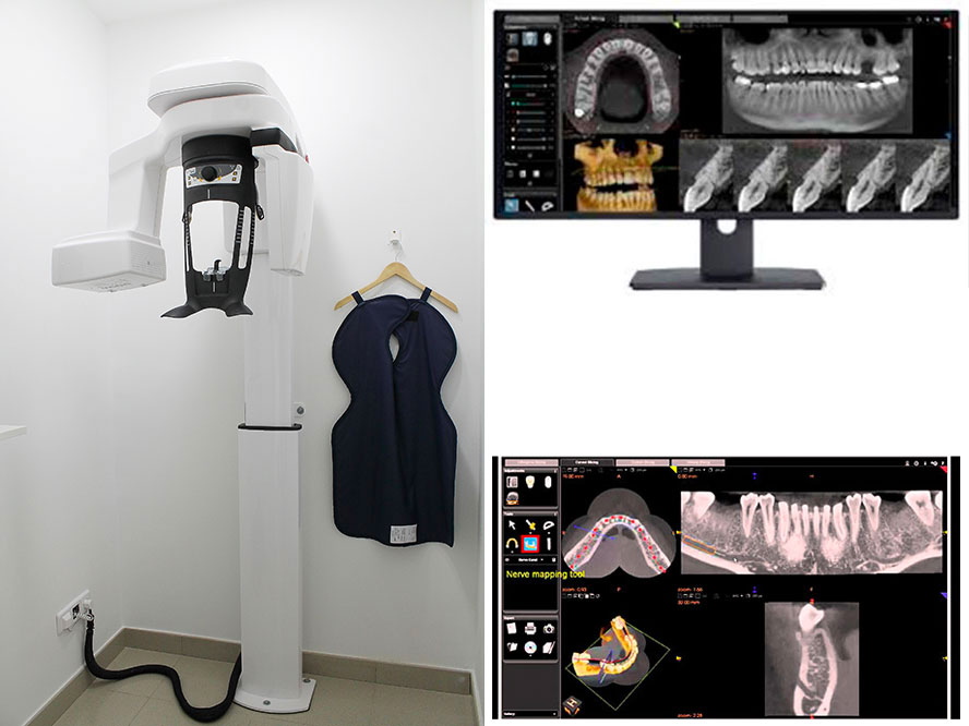 Equipo TAC dental 3D Acuadental Arganda del Rey